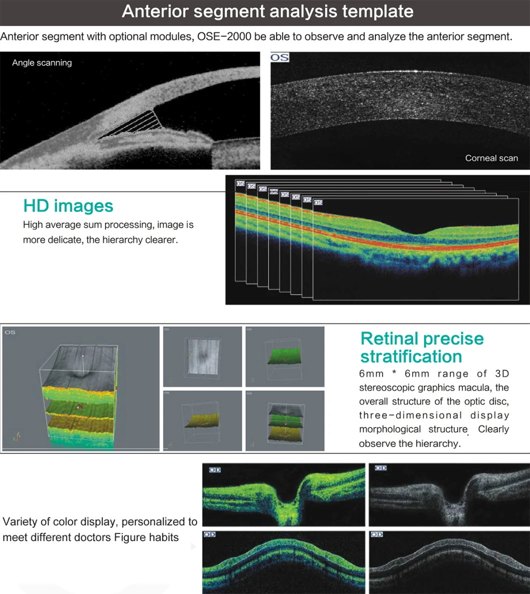 Great Price Ose-2000 Optical Coherence Tomography Oct Machine