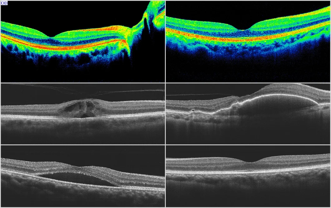 Great Price Ose-2000 Optical Coherence Tomography Oct Machine