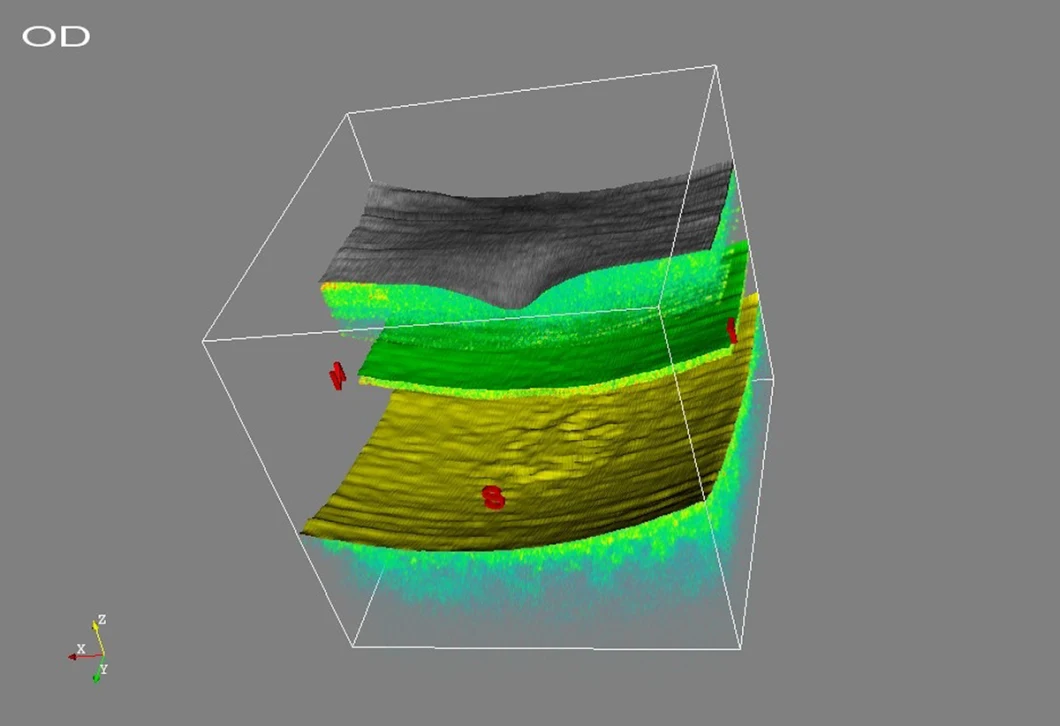 Great Price Ose-2000 Optical Coherence Tomography Oct Machine