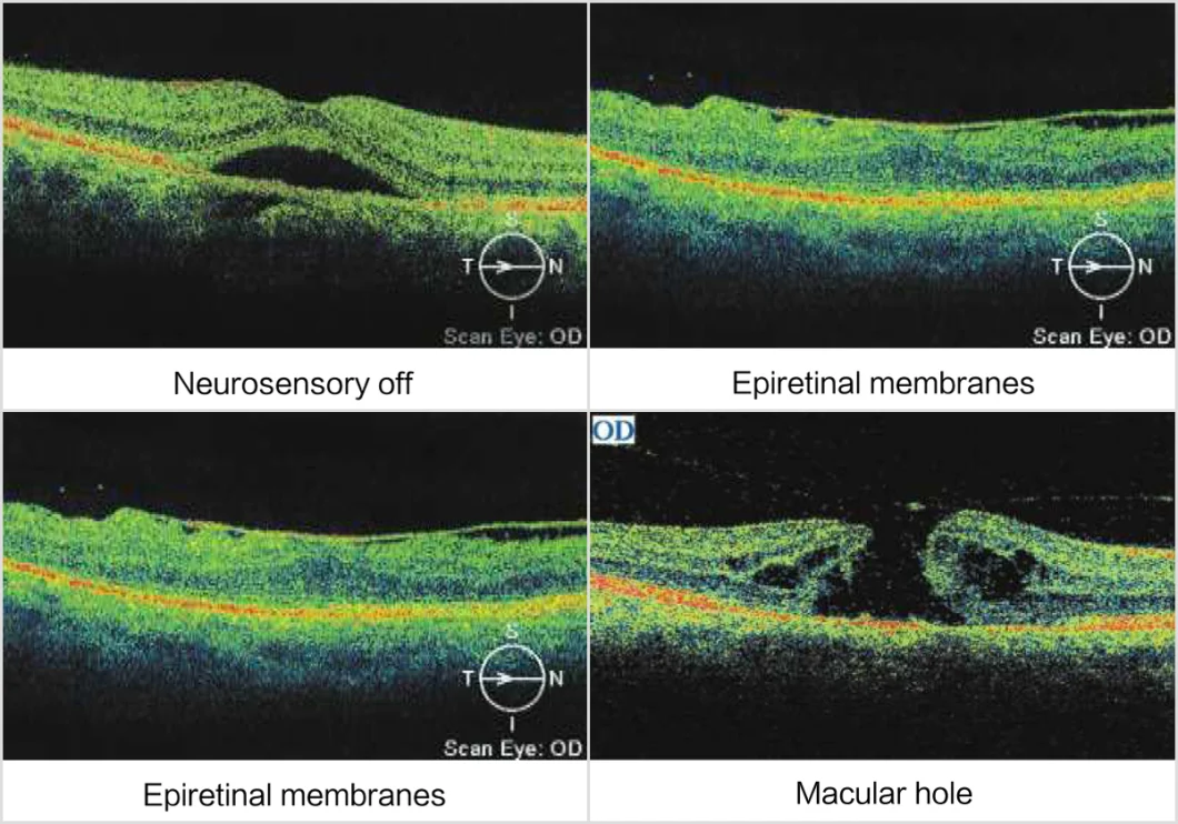 Great Price Ose-2000 Optical Coherence Tomography Oct Machine